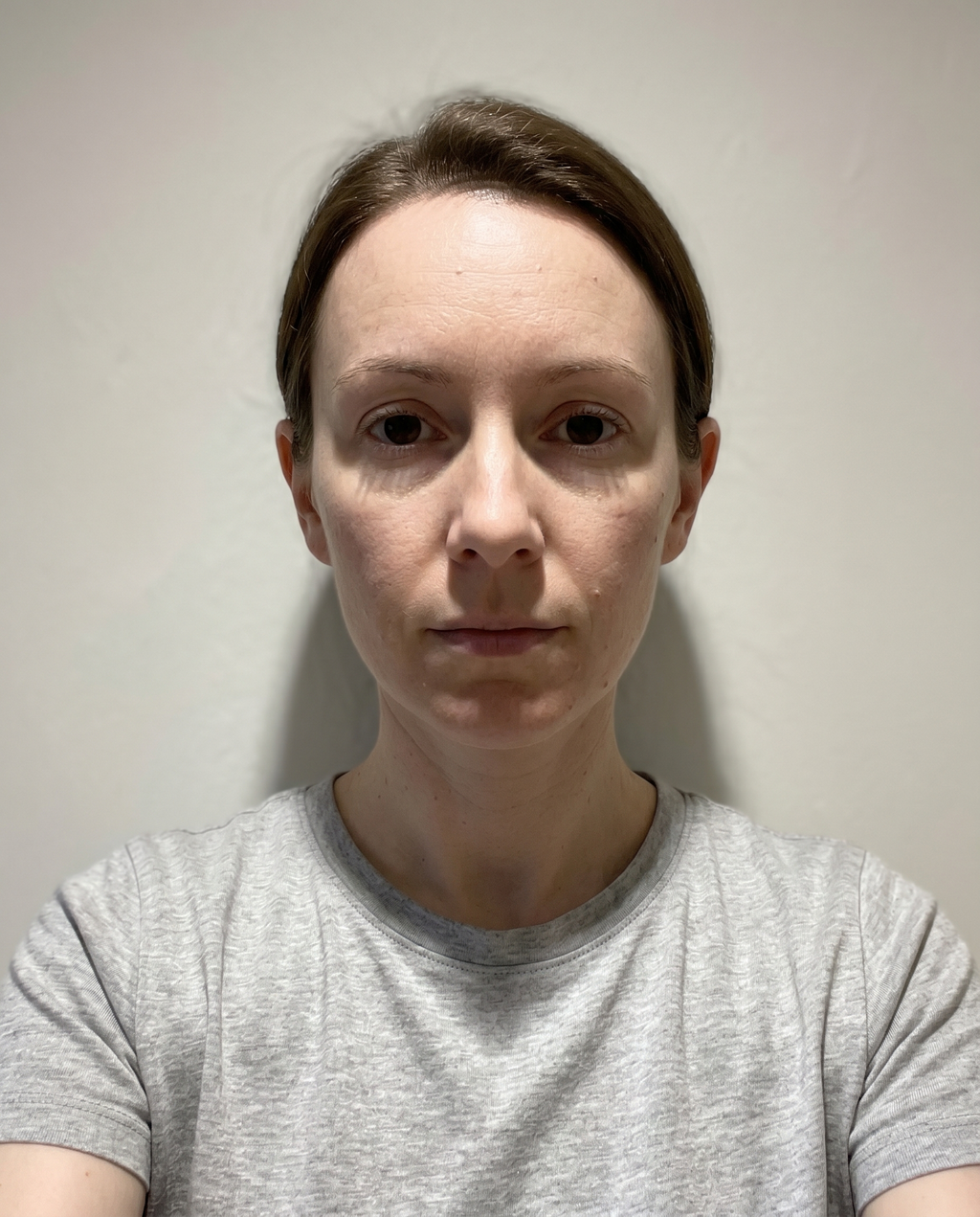 Selfie taken in mixed artificial lighting showing inconsistent color temperature across face